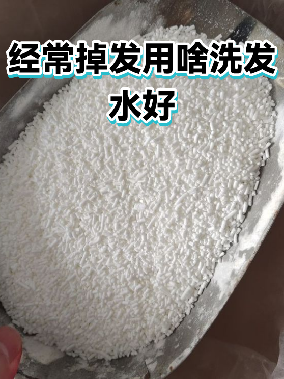 经常掉发用啥洗发水好（图1）